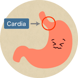 cardia image